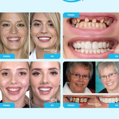 SMILEFIT PRO – РЕГУЛИРУЕМ КОМПЛЕКТ ЗЪБИ ЗА ПЕРФЕКТНА УСМИВКА